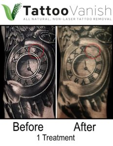 Tattoo Vanish Method Before and After