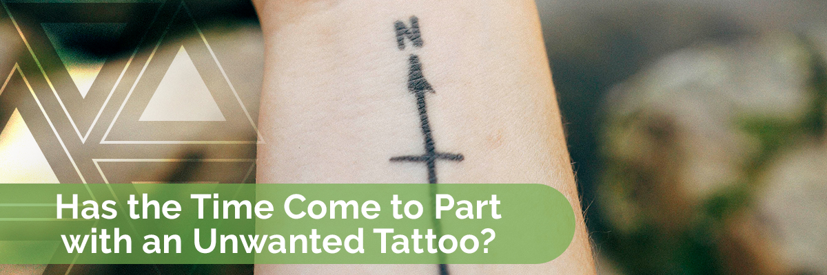 Has the time come to part with an unwanted tattoo?