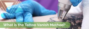 Tattoo Vanish is the best tattoo removal system that exists. With Tattoo Vanish, there are no acids, toxins or surgical interventions required.