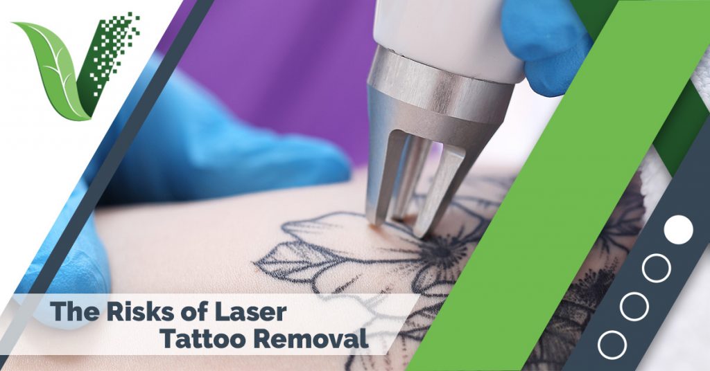 What Are The Risks Of Laser Tattoo Removal On Hands?